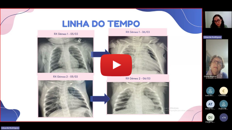 Raciocínio Clínico: Doença Exantemática e seus Diagnósticos Diferencial - Dia 21 de maio de 2025 Raciocínio Clínico: Doença Exantemática e seus Diagnósticos Diferencial - Dia 21 de maio de 2025