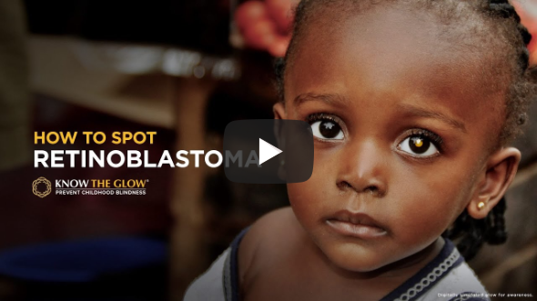 How to spot Retinoblastoma How to spot Retinoblastoma
