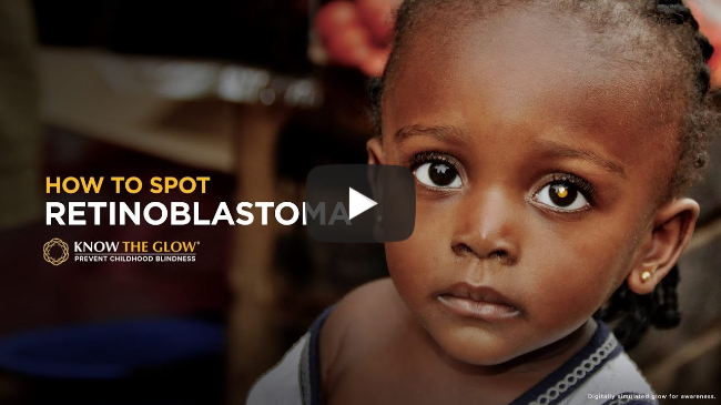 How to spot Retinoblastoma