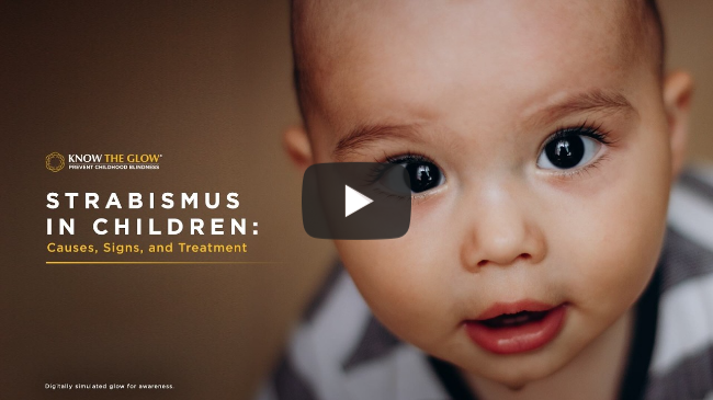 Strabismus in Children: Causes, Signs, and Treatment